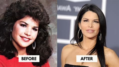 lauren sanchez surgery